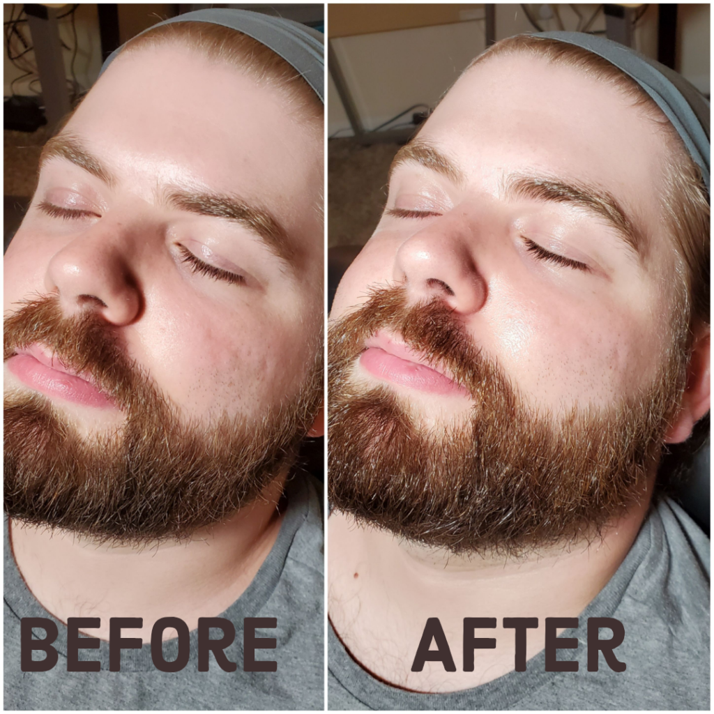 Men’s facial before and after, at home facial for men